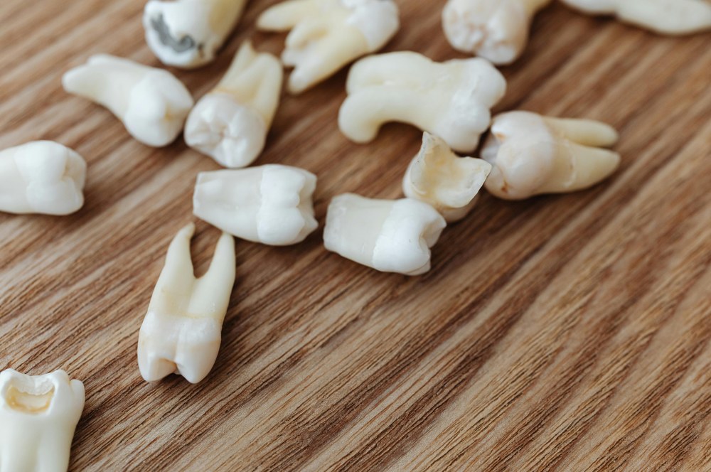 Кариес и пародонтит: диагностика, лечение и ключ к долгосрочному здоровью десен