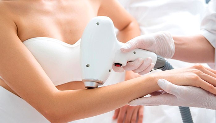 Лазерна епіляція сьогодні – як виглядає курс, коли все сплановано